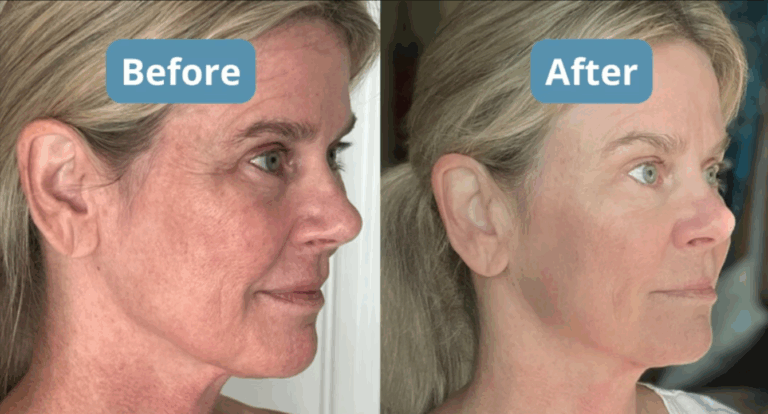 Total Night Cream Benefits